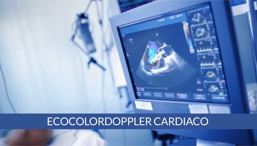 Ecocardiografia (ecocolordoppler cardiaco)
